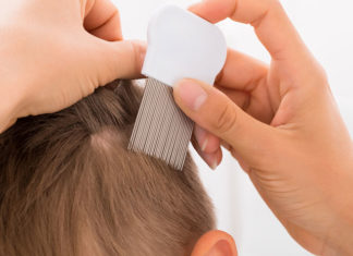 Jak zdiagnozować i leczyć wszawicę?